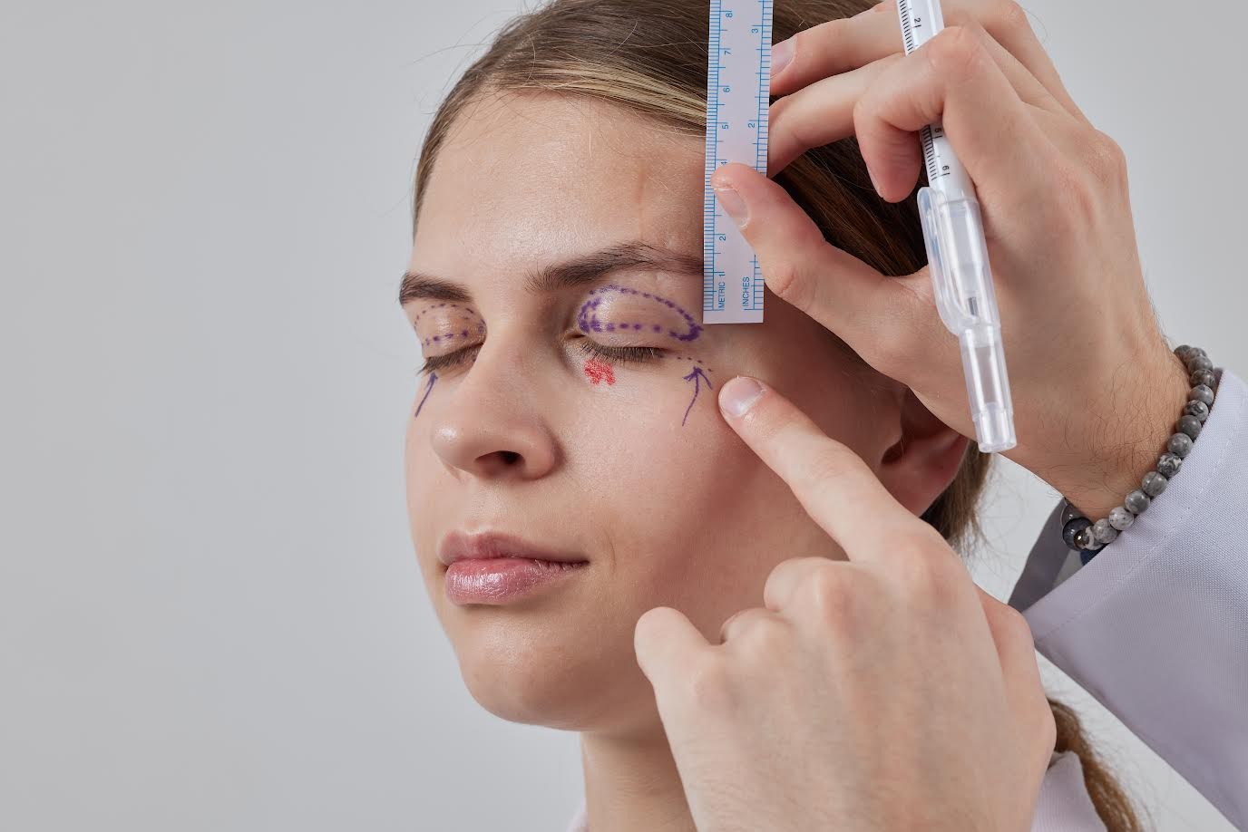 Blefaroplastia exige avaliação pré-cirúrgica individualizada