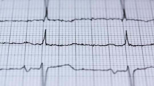 SP registra alta de 8% nos transplantes de coração em 2023
