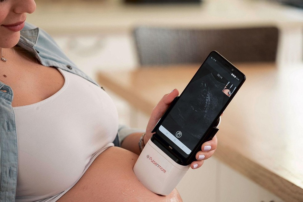 Dispositivo portátil conectado ao smartphone de paciente do Santa Joana — Foto: Divulgação