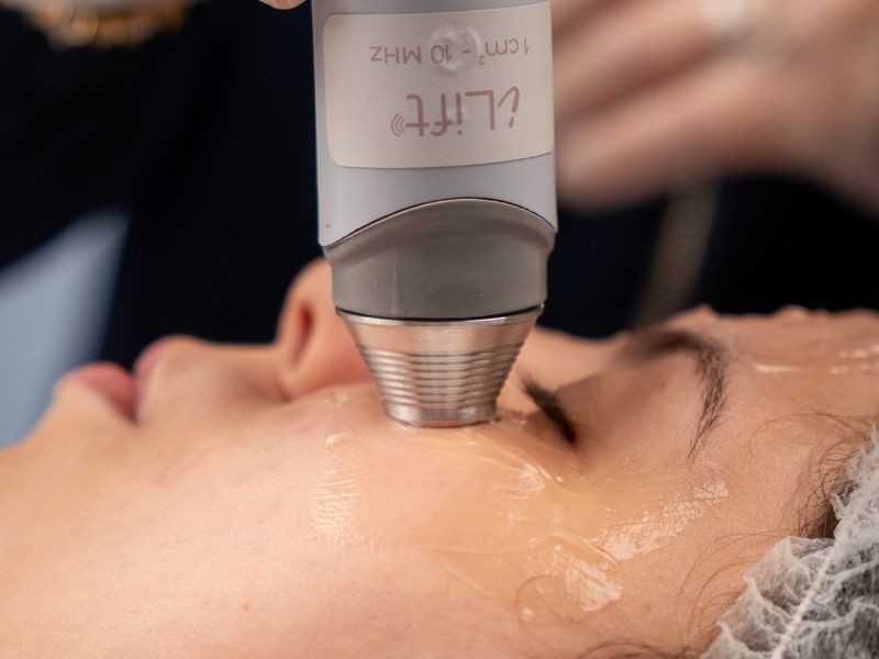 IBRAMED lança ultrassom terapêutico de 5 MHz e 10 MHz