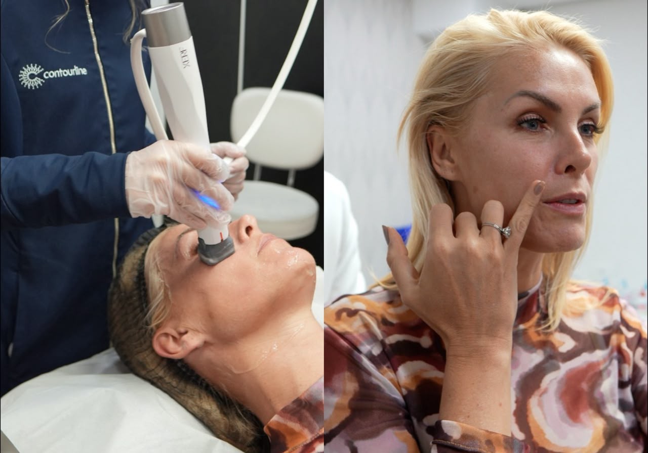 XERF conquista celebridades que buscam a renovação da beleza