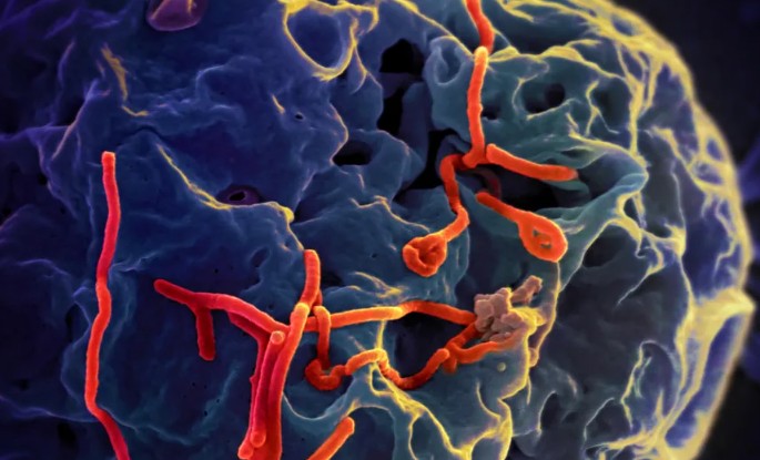 Paciente em SP testou positivo para meningite, Ebola ainda está sob investigação