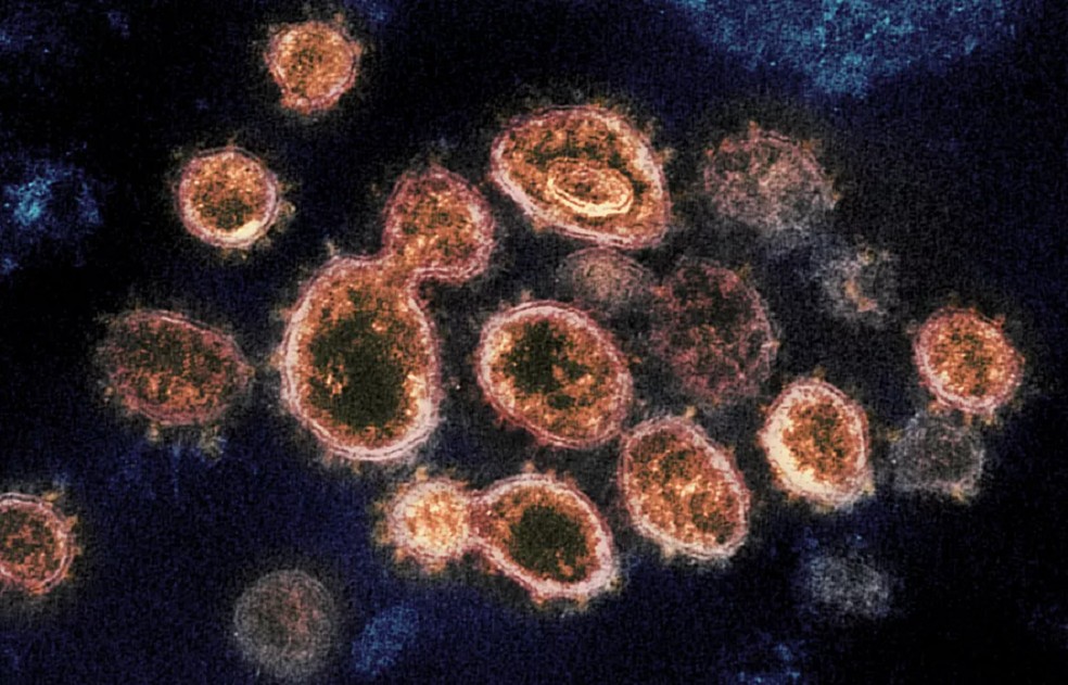 Coronavírus vistos por um microscópio eletrônico  — Foto: Divulgação/NIAID/NIH