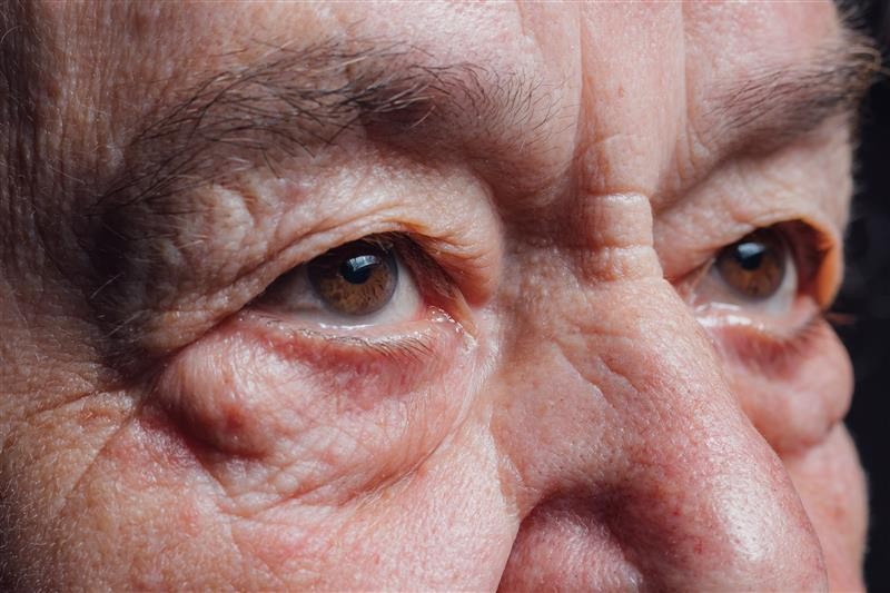 TJMG: Mulher será indenizada por assimetria nos olhos após cirurgia nas pálpebras - QTU Questões do Universo
