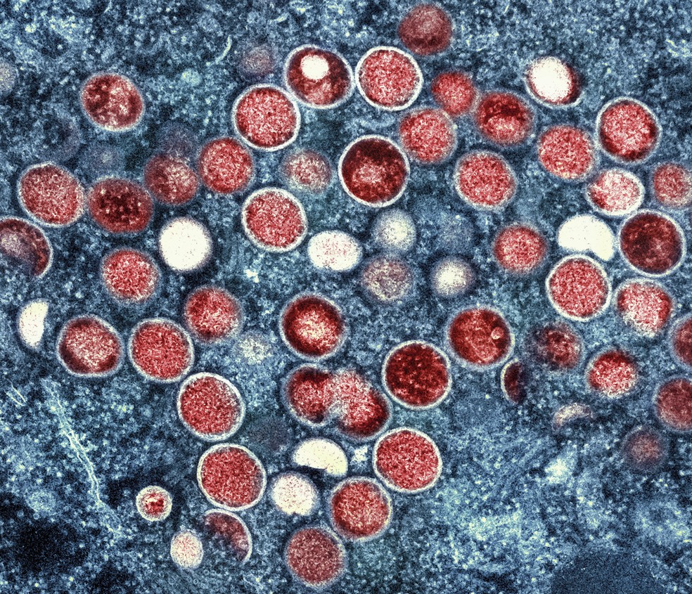 Transmissão da mpox pode ocorrer entre pessoas infectadas pelo mpox vírus, materiais contaminados ou roedores infectados — Foto: National Institute of Allergy and Infectious Diseases/AP