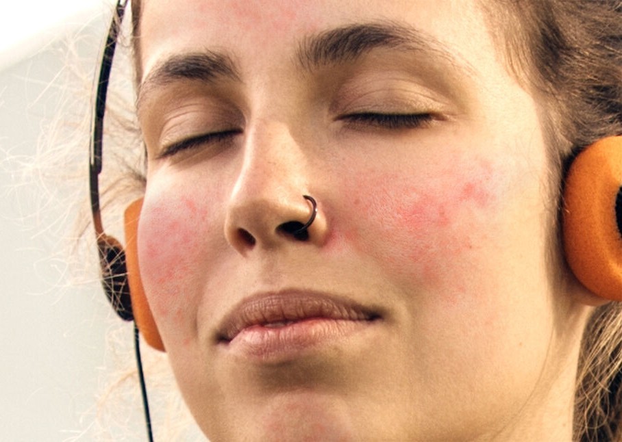 Pele sensível: especialista alerta para sinais e tratamentos