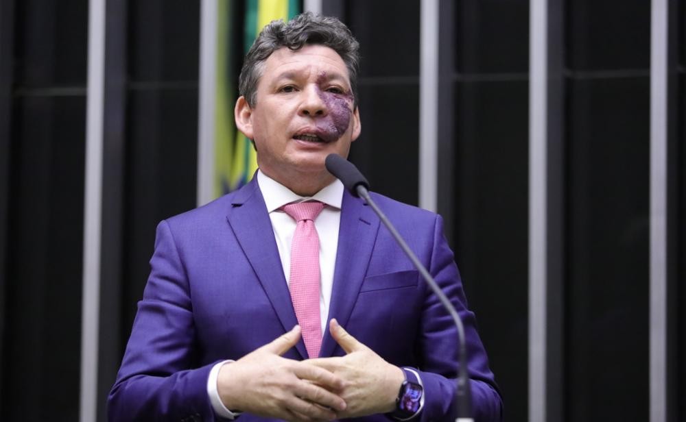 Governo vai incluir dispositivo à MP da taxa das blusinhas para Fazenda avaliar impacto à indústria, diz Lopes