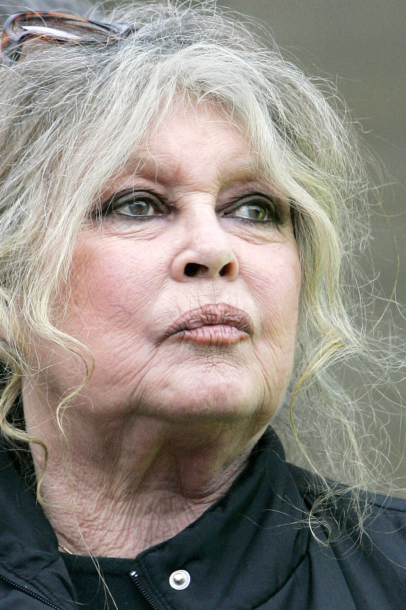 Brigitte Bardot está internada em estado grave e fez cirurgia de emergência
