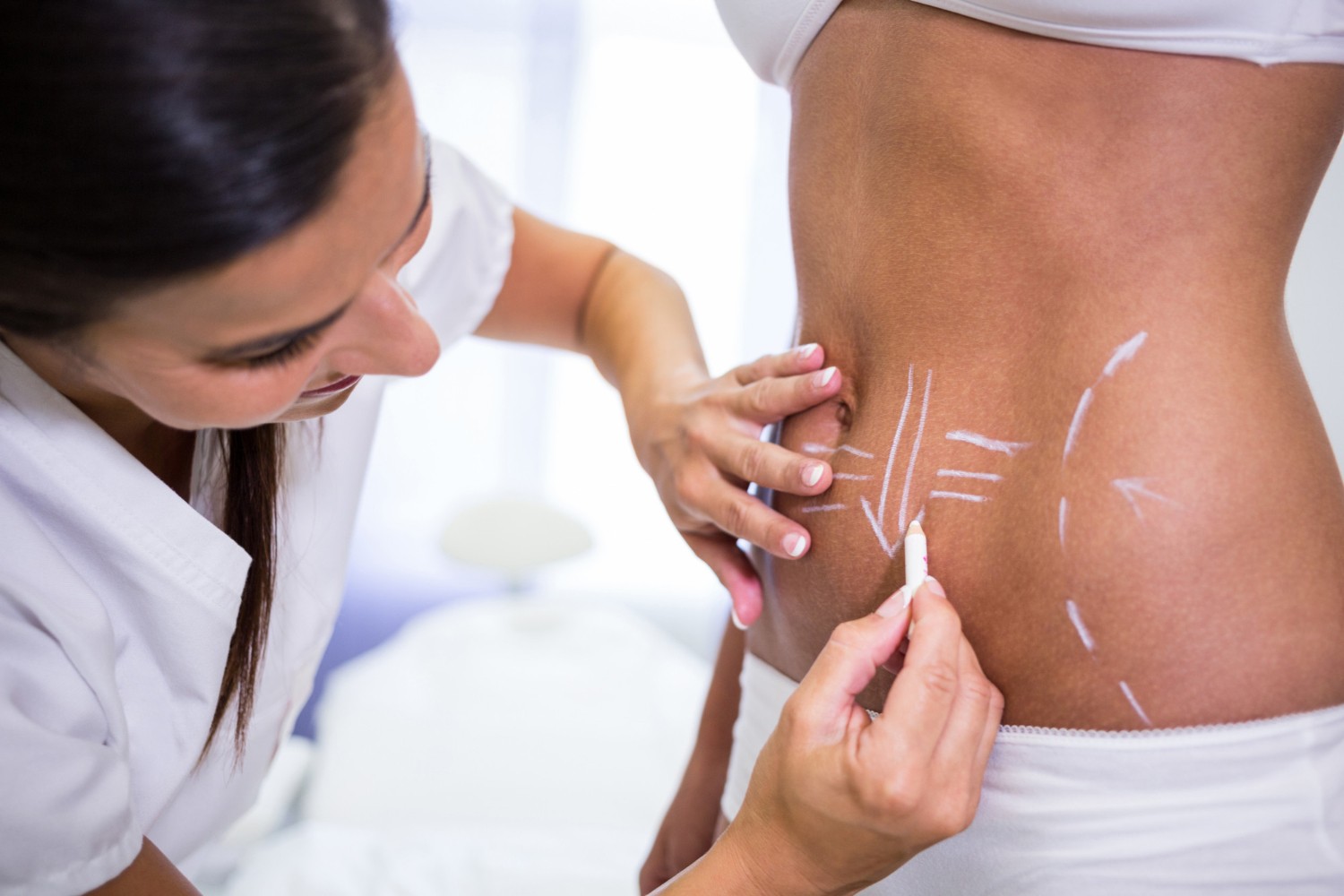 Lipo HD amplia possibilidades da definição corporal